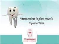 Dental implant tedavisi